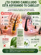 Shampoo Treko